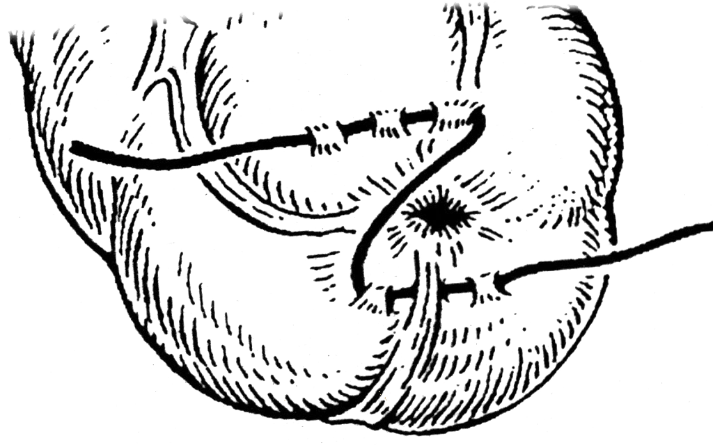 Правой кнопкой мышки можно открыть изображение - оно будет больше!
